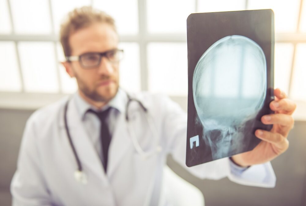 All About Concussions: Signs, Symptoms, and Treatment