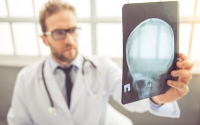 All About Concussions: Signs, Symptoms, and Treatment